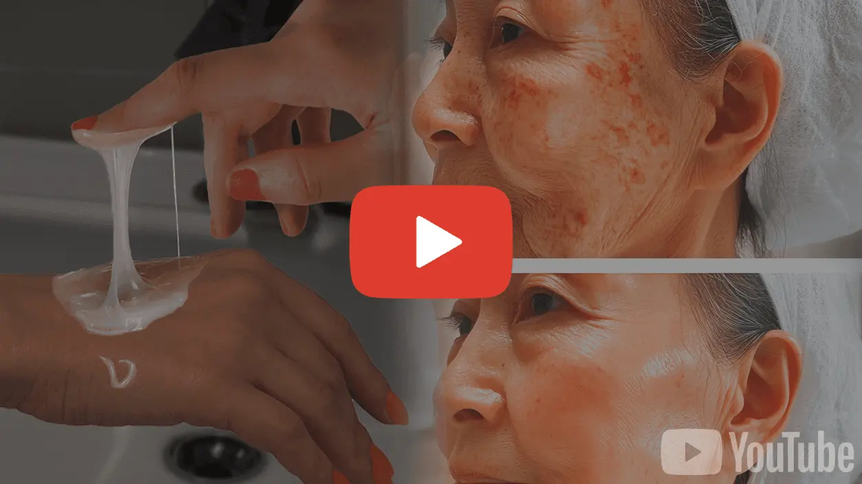 Click to watch video about #1 dark spot remover