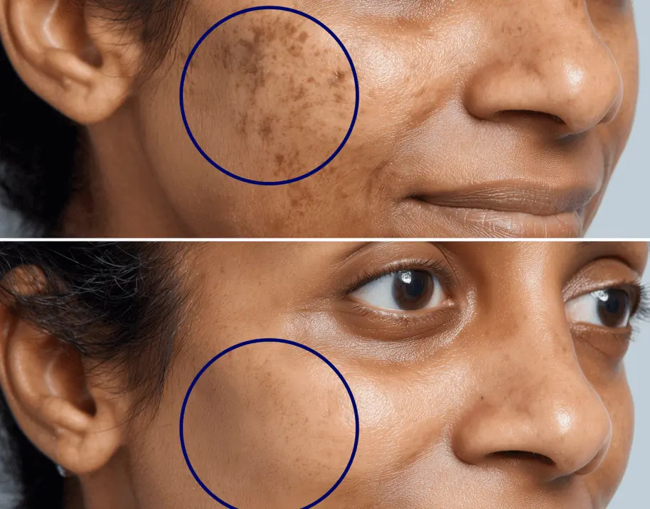 Before and after face comparison