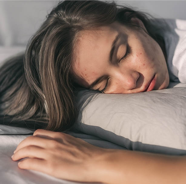 Skin worse after sleep